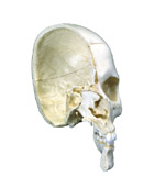 A280: BONElike™ Skull - Bony skull half, 4-part
