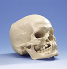 A29/1: Microcephalic Skull