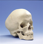 A29/2: Hydrocephalic Skull