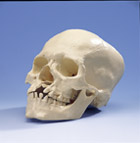 A29/3: Skull with Cleft Jaw and Plate