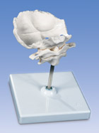 A71/5: Atlas and Axis, with occipital plate