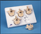 A792: Set of 5 Lumbar Vertebrae