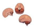 C15: Brain, 2-part