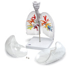 G23/1: CT bronchial tree with larynx and transparent lungs