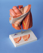 H13: Inguinal hernia model