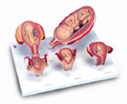 L11/9: 3B Scientific® Pregnancy Series, 5 Models
