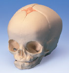 A25: Fetal Skull