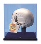 A27/9: Deluxe Demonstration Skull, with display case