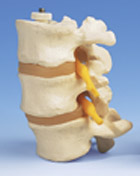 A76/8: 3 Lumbar Vertebrae, flexibly mounted