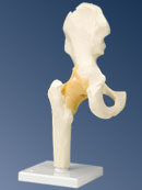 A81: Functional Hip Joint