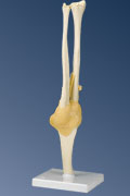 A83: Functional Elbow Joint