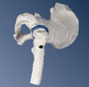 A84: Mini Hip Joint