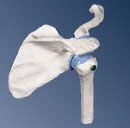 A86: Mini Shoulder Joint