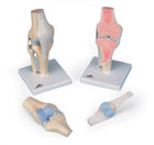 A89: Sectional knee joint model, 3-part