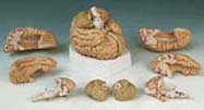 C17: Brain, 8-part
