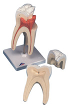 D10/5: Upper Triple-Root Molar, 3-part