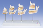 D20: Dentition Development