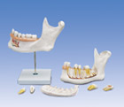 D25: Half Lower Jaw, 3 times full-size, 6-part