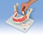 D26: Dental disease, magnified 2 times, 21 parts