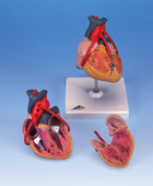 G05: Classic Heart with Bypass, 2-part