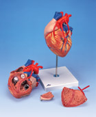 G06: Heart with Bypass, 2 times life-size, 4-part