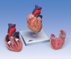 G08: Classic Heart, 2-part