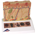 J15: Skin Cancer Model