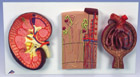 K11: Kidney Section, Nephrons, Blood Vessels and Renal Corpuscle