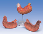 K15: Stomach, 2-part