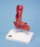 K18: Diseases of the Oesophagus