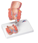 K27: Haemorrhoid Model