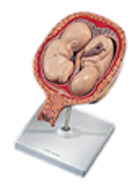 L10/7: 5th Month Twin Foetuses, normal position