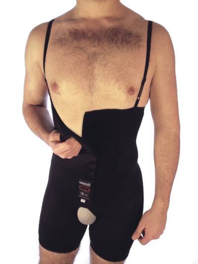 Above Knee Compression Garment with Velcro® and Suspenders