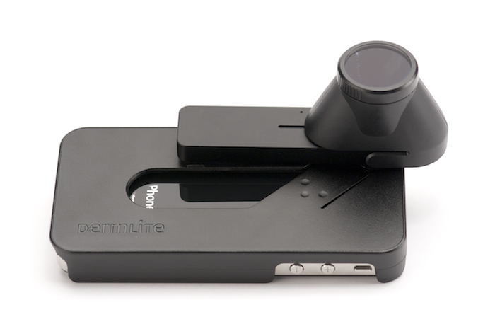 DermLite DL1 Dermatoscope